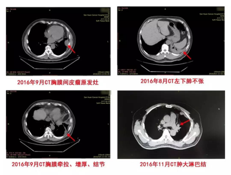 出国看病服务机构,出国看病,跨境医疗