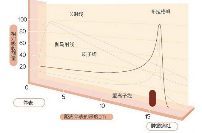 早癌筛查,美国看病,德国看病,日本看病